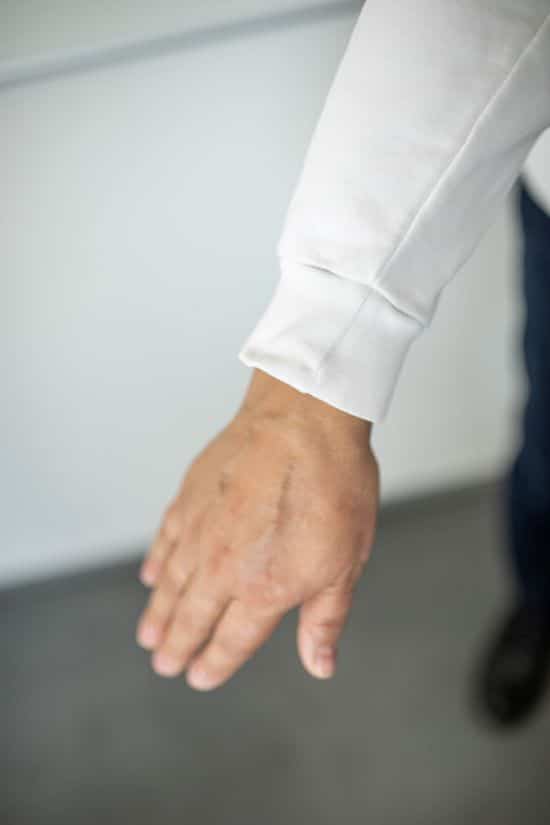 Blogbild Aermelnaht auf Handruecken